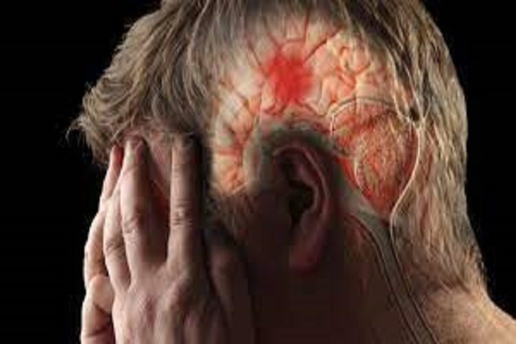 آمار بالای بروز سکته های مغزی در خراسان شمالی