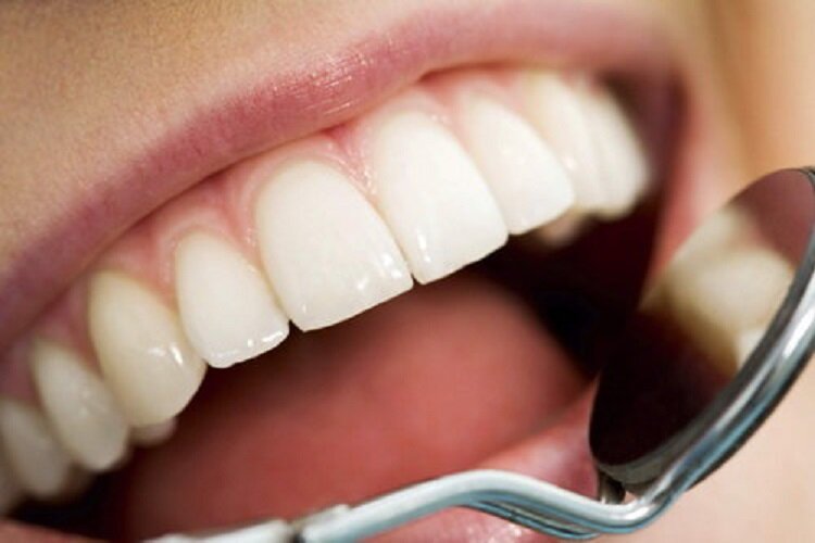 اثرات مخرب نوشابه و قهوه بر سلامت دندان‌ها