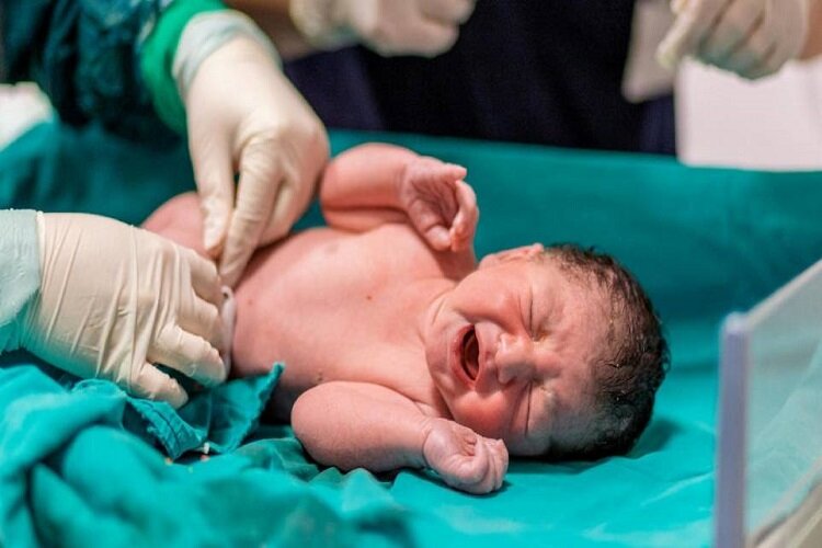 تولد ۷۳۴۲ نوزاد در بیمارستان‌های تحت پوشش دانشگاه علوم پزشکی خراسان شمالی